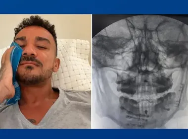 Imagem ilustrativa da imagem Danilo, do Flamengo, mostra recuperação após fratura na mandíbula