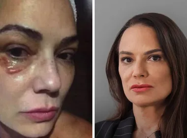 Imagem ilustrativa da imagem Luiza Brunet comenta indenização de R$ 150 mil por agressão de ex