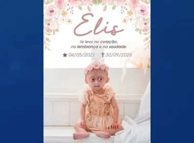 Imagem ilustrativa da imagem Morre Elis, gêmea com síndrome de envelhecimento precoce; entenda a doença