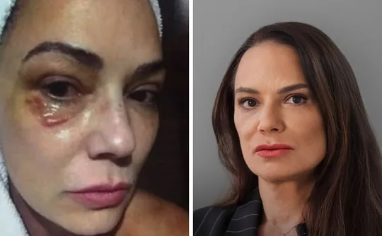 Imagem ilustrativa da imagem Luiza Brunet comenta indenização de R$ 150 mil por agressão de ex