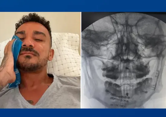 Imagem ilustrativa da imagem Danilo, do Flamengo, mostra recuperação após fratura na mandíbula