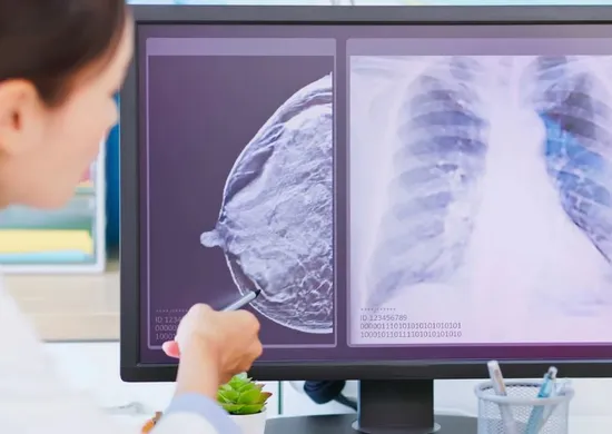 Imagem ilustrativa da imagem IA já ajuda médicos na detecção do câncer de mama