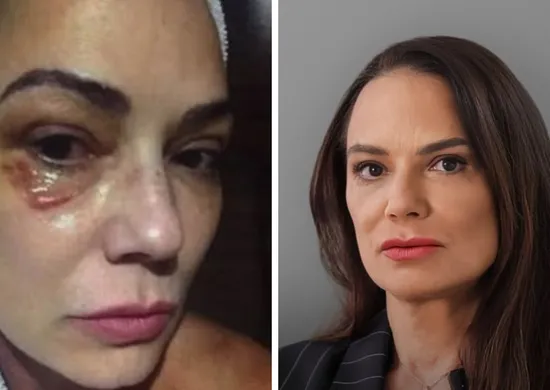 Imagem ilustrativa da imagem Luiza Brunet comenta indenização de R$ 150 mil por agressão de ex