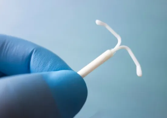 Imagem ilustrativa da imagem Planos de saúde terão que cobrir DIU hormonal em casos de endometriose