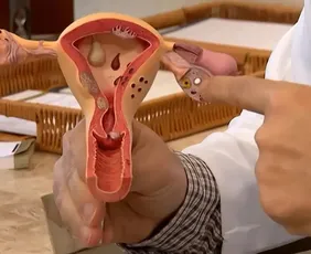 Imagem ilustrativa da imagem Uma em cada 10 mulheres tem sinais de endometriose