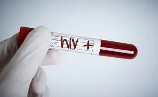 Imagem ilustrativa da imagem Empresa do ES é condenada por discriminar e demitir funcionária com HIV