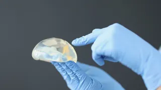 Imagem ilustrativa da imagem Anvisa proíbe importação e uso de novos lotes de prótese de silicone chinesa