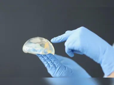 Imagem ilustrativa da imagem Anvisa proíbe importação e uso de novos lotes de prótese de silicone chinesa