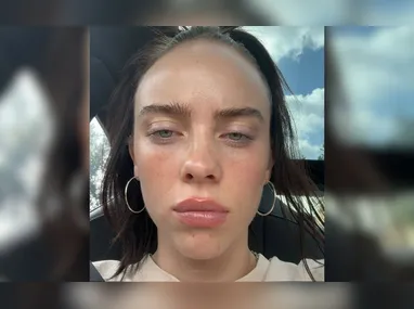 Imagem ilustrativa da imagem 'Muito brancos': fãs criticam Billie Eilish e apontam fala racista em show