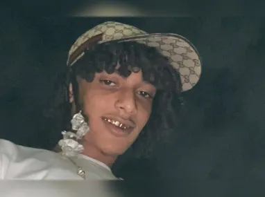 Val Marchiori publicou fotos no Instagram e falou sobre etapas de tratamento