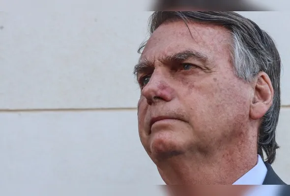 Imagem ilustrativa da imagem Defesa de Bolsonaro pede visita de médica após agravamento de soluços