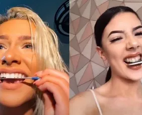 Imagem ilustrativa da imagem Especialistas alertam para moda perigosa que pode levar à perda de dentes
