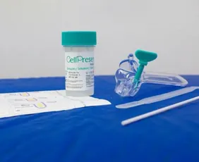 Imagem ilustrativa da imagem Guia orienta sobre mudança no rastreamento do câncer de colo do útero