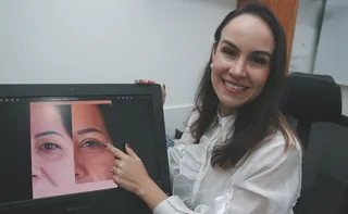 Imagem ilustrativa da imagem Blefaroplastia: conheça a cirurgia que supera a lipo na busca pela beleza