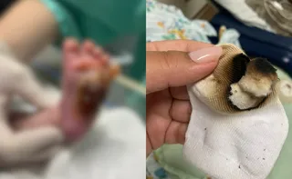 Imagem ilustrativa da imagem Família denuncia procedimento feito em recém-nascido em hospital da Serra