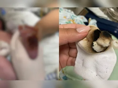 “Dormi em poltrona para ficar com meu filho”: mãe relata abandono no hospital