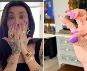 Imagem ilustrativa da imagem Maya Massafera mostra resultado após retirar ossos do rosto