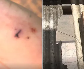 Imagem ilustrativa da imagem Mulher e irmã são presas suspeitas de tentar esfaquear ex-companheiro em Viana