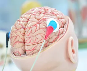 Imagem ilustrativa da imagem Unesco faz recomendação inédita para uso ético da neurotecnologia