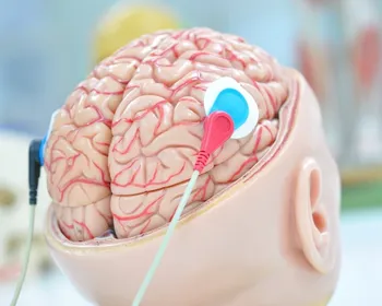 Imagem ilustrativa da imagem Unesco faz recomendação inédita para uso ético da neurotecnologia