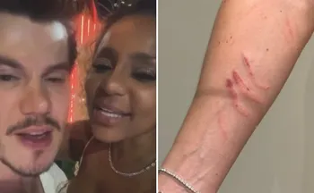 Imagem ilustrativa da imagem Cariúcha acusa médico de agressão; ele nega e afirma ter sido arranhado por ela