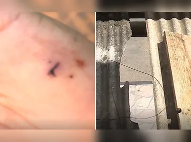 Imagem ilustrativa da imagem Mulher e irmã são presas suspeitas de tentar esfaquear ex-companheiro em Viana