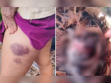 Imagem ilustrativa da imagem Suspeito é preso após espancar e manter ex-companheira em cárcere privado