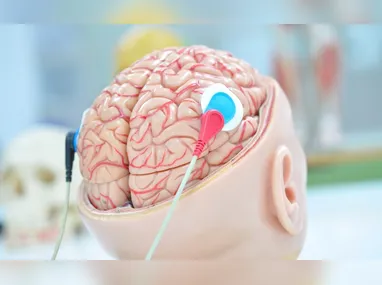 Imagem ilustrativa da imagem Unesco faz recomendação inédita para uso ético da neurotecnologia