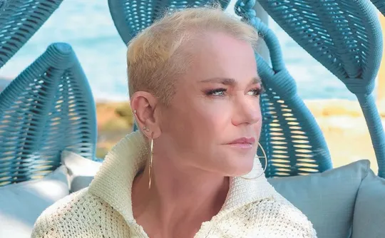 Imagem ilustrativa da imagem Estenose de canal: entenda as causas e tratamentos do problema que afeta Xuxa