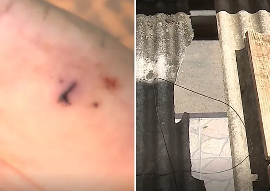 Imagem ilustrativa da imagem Mulher e irmã são presas suspeitas de tentar esfaquear ex-companheiro em Viana