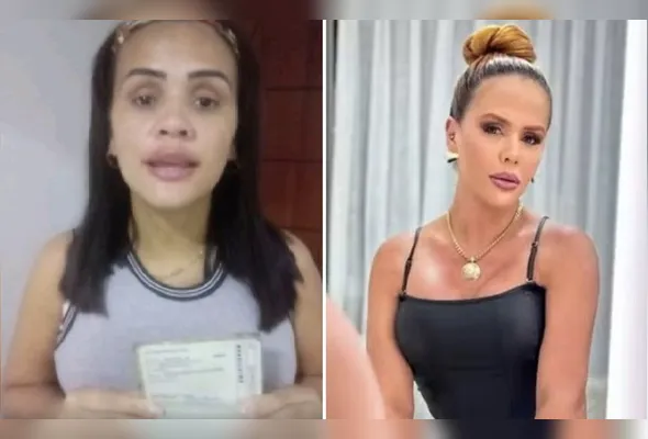 Camila Francis da Silva antes e depois dos procedimentos estéticos