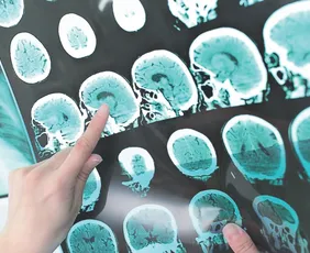 Imagem ilustrativa da imagem Avanços na medicina: estudos podem mudar diagnósticos no futuro