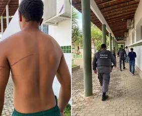 Imagem ilustrativa da imagem Estudante de 15 anos é agredido por colegas em internato no Noroeste do ES