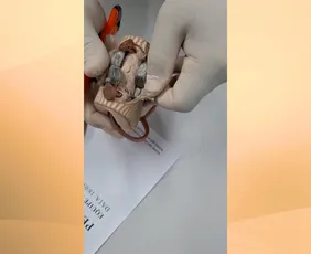 Imagem ilustrativa da imagem VÍDEO | Mulher tenta entrar em presídio em Vila Velha com drogas no chinelo