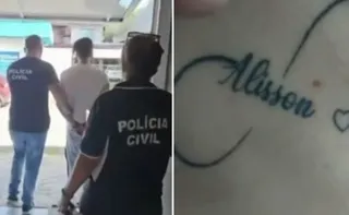 Imagem ilustrativa da imagem Dentista é preso suspeito de forçar companheira a tatuar nome dele dez vezes em SC