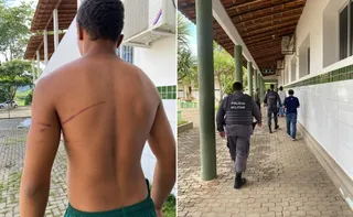 Imagem ilustrativa da imagem Estudante de 15 anos é agredido por colegas em internato no Noroeste do ES