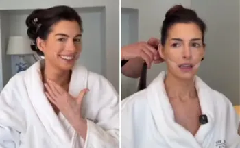 Imagem ilustrativa da imagem 'Facelift' sem cirurgia: Anne Hathaway revela truque que usou no Oscar 2026