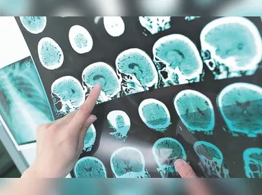 Das principais infecções causadoras de SRAG, três podem ser prevenidas por vacinas disponíveis no SUS: Influenza A, Influenza B e Covid-19