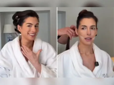 Imagem ilustrativa da imagem 'Facelift' sem cirurgia: Anne Hathaway revela truque que usou no Oscar 2026