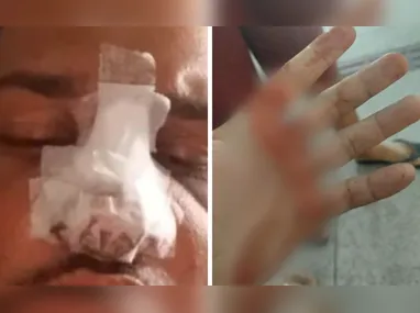 Imagem ilustrativa da imagem Jovem tem nariz quebrado após agressão dentro de coletivo em Vila Velha