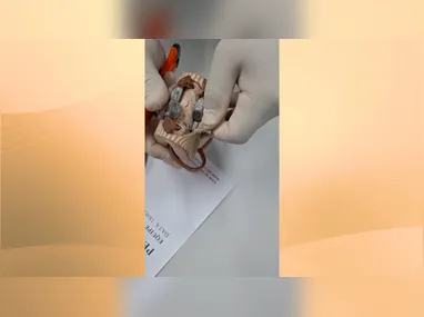 Viatura da Polícia Civil