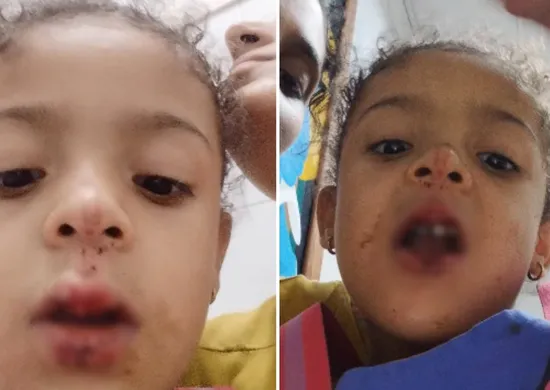 Imagem ilustrativa da imagem Menina de 4 anos fica ferida após ser atropelada por bike elétrica em Vila Velha