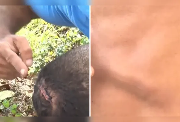 Vítima sofreu um corte profundo na cabeça, além de ferimentos no tórax, mãos e rosto