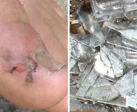 Imagem ilustrativa da imagem Suspeito é preso após invadir casa de ex e usar cacos de vidro para feri-la