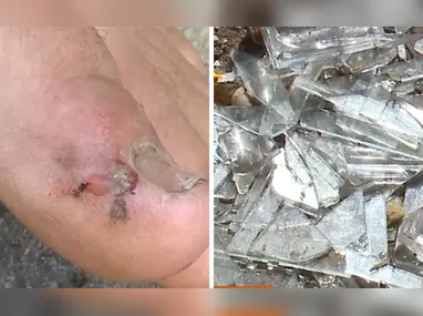 Guarda Municipal atendeu a ocorrência e deteve o suspeito, que resistiu à prisão