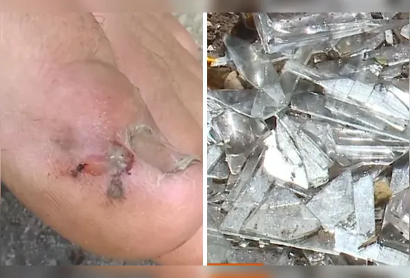 Vítima foi ferida pelo ex-namorado com um caco de vidro