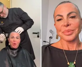 Imagem ilustrativa da imagem Gretchen raspa a cabeça ao vivo antes de transplante capilar feito no ES