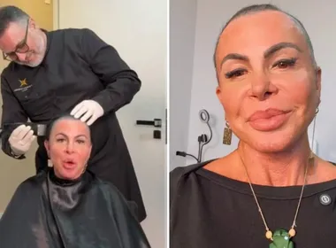 Imagem ilustrativa da imagem Gretchen raspa a cabeça ao vivo antes de transplante capilar feito no ES