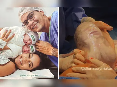Imagem ilustrativa da imagem Gêmea nasce empelicada e momento raro é registrado por storymaker no ES