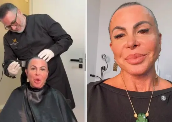 Imagem ilustrativa da imagem Gretchen raspa a cabeça ao vivo antes de transplante capilar feito no ES